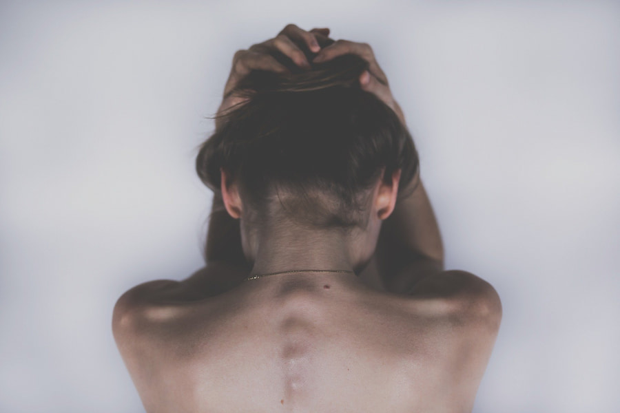 anorexia infantil
